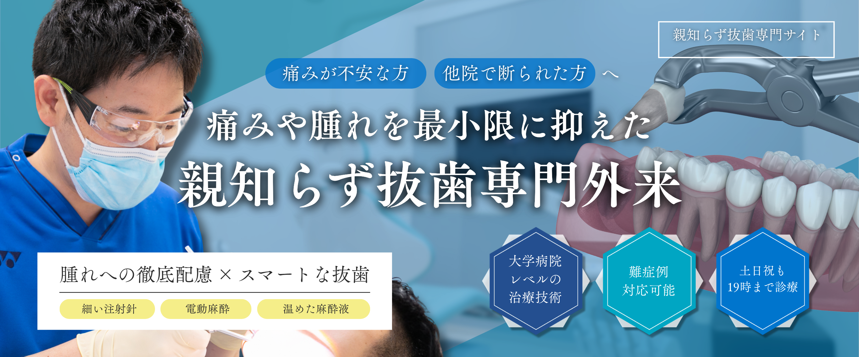 親知らずの抜歯について