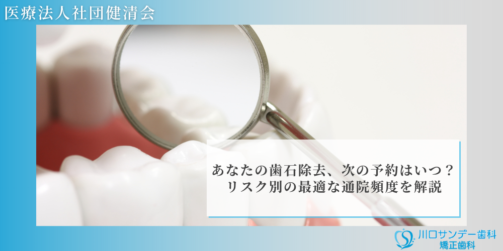 あなたの歯石除去、次の予約はいつ？リスク別の最適な通院頻度を解説