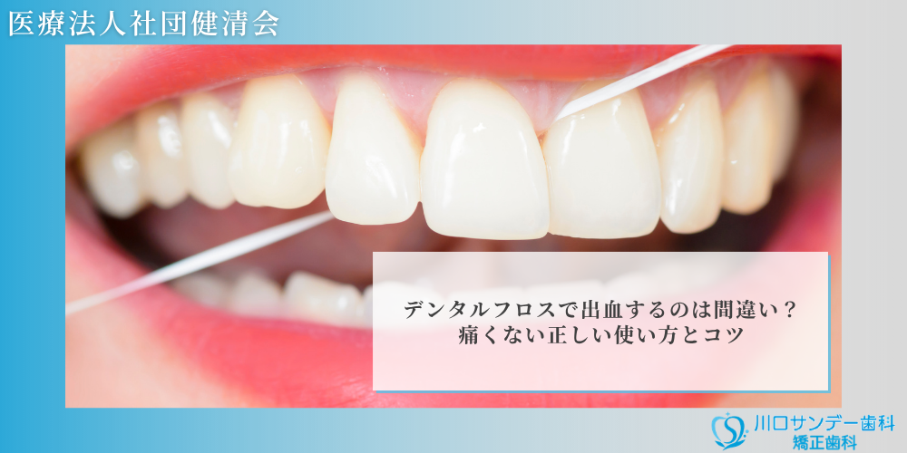 デンタルフロスで出血するのは間違い？痛くない正しい使い方とコツ