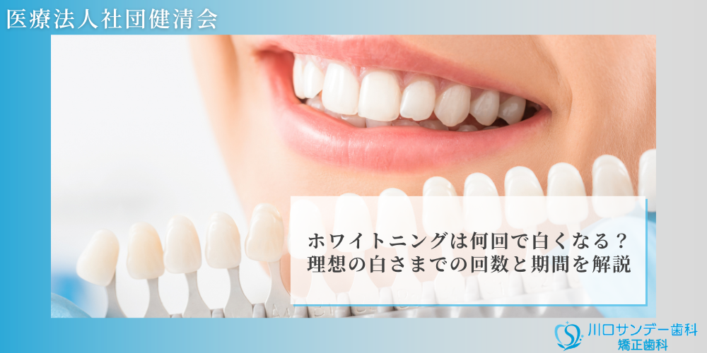 ホワイトニングは何回で白くなる？理想の白さまでの回数と期間を解説
