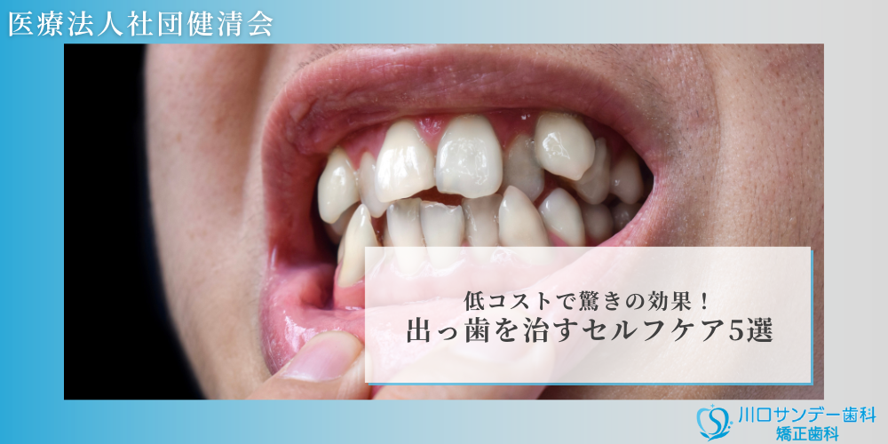 低コストで驚きの効果！出っ歯を治すセルフケア5選