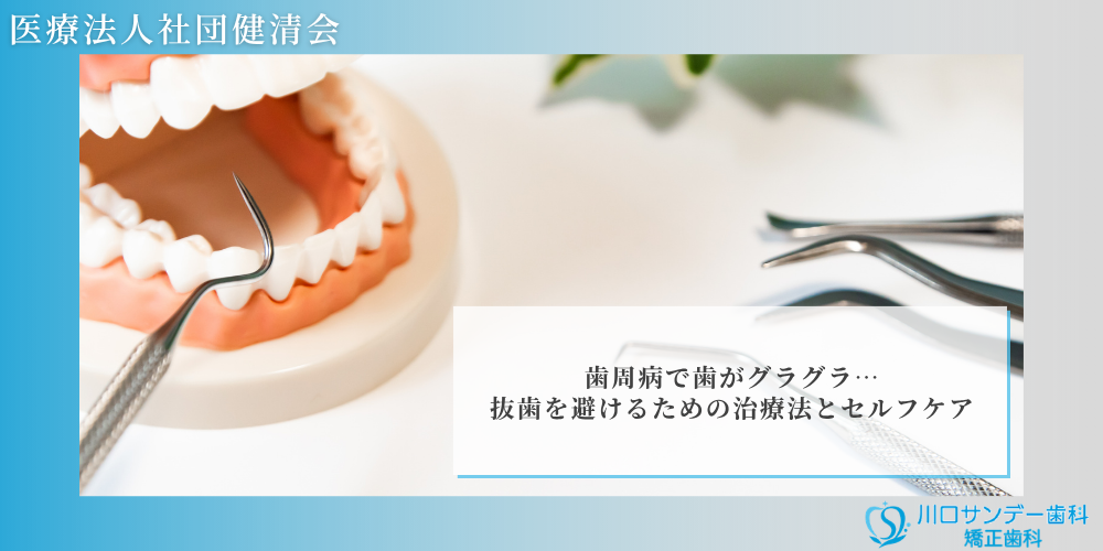歯周病で歯がグラグラ…抜歯を避けるための治療法とセルフケア