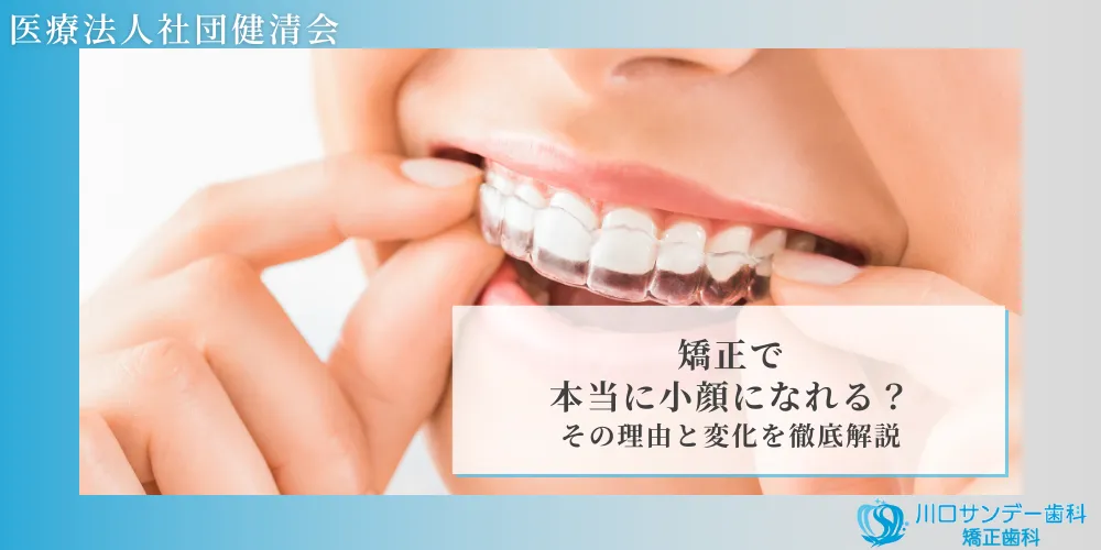 矯正で本当に小顔になれる？その理由と変化を徹底解説