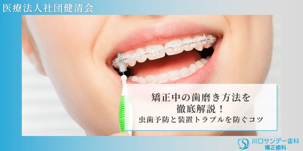 矯正中の歯磨き方法を徹底解説！虫歯予防と装置トラブルを防ぐコツ