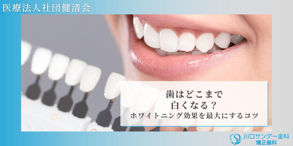 歯はどこまで白くなる？ホワイトニング効果を最大にするコツ